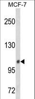 INPP4B Antibody - Western blot of INPP4B Antibody in MCF-7 cell line lysates (35 ug/lane). INPP4B (arrow) was detected using the purified antibody.