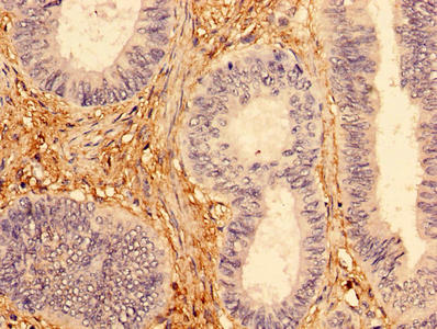 INPP5A Antibody - Immunohistochemistry of paraffin-embedded human kidney tissue using INPP5A Antibody at dilution of 1:100