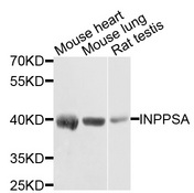 INPP5A Antibody - Western blot analysis of extracts of various cells.