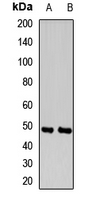 INPP5A Antibody - Western blot analysis of INPP5A expression in mouse lung (A), rat testis (B) 35 ug of whole cell lysates.