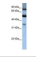INPP5B Antibody - Hela cell lysate. Antibody concentration: 1.0 ug/ml. Gel concentration: 12%.  This image was taken for the unconjugated form of this product. Other forms have not been tested.