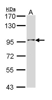 INPP5B Antibody - Sample (30 ug of whole cell lysate). A: H1299. 7.5% SDS PAGE. INPP5B antibody diluted at 1:1000.