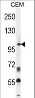 INPP5B Antibody - INPP5B Antibody western blot of CEM cell line lysates (35 ug/lane). The INPP5B antibody detected the INPP5B protein (arrow).
