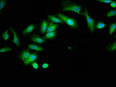 INPP5B Antibody - Immunofluorescence staining of Hela cells at a dilution of 1:133, counter-stained with DAPI. The cells were fixed in 4% formaldehyde, permeabilized using 0.2% Triton X-100 and blocked in 10% normal Goat Serum. The cells were then incubated with the antibody overnight at 4 °C.The secondary antibody was Alexa Fluor 488-congugated AffiniPure Goat Anti-Rabbit IgG (H+L) .