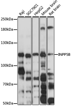 INPP5B Antibody - Western blot analysis of extracts of various cell lines, using INPP5B antibody at 1:3000 dilution. The secondary antibody used was an HRP Goat Anti-Rabbit IgG (H+L) at 1:10000 dilution. Lysates were loaded 25ug per lane and 3% nonfat dry milk in TBST was used for blocking. An ECL Kit was used for detection and the exposure time was 15s.