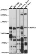 INPP5B Antibody - Western blot analysis of extracts of various cell lines, using INPP5B antibody at 1:3000 dilution. The secondary antibody used was an HRP Goat Anti-Rabbit IgG (H+L) at 1:10000 dilution. Lysates were loaded 25ug per lane and 3% nonfat dry milk in TBST was used for blocking. An ECL Kit was used for detection and the exposure time was 15s.
