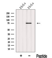 INPP5B Antibody - Western blot analysis of extracts of HeLa cells using INPP5B antibody. The lane on the left was treated with blocking peptide.