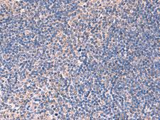 INPP5B Antibody - Immunohistochemistry of paraffin-embedded Human tonsil tissue  using INPP5B Polyclonal Antibody at dilution of 1:40(×200)