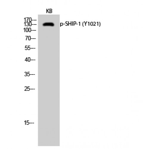 INPP5D / SHIP1 / SHIP Antibody - Western blot of Phospho-SHIP-1 (Y1021) antibody