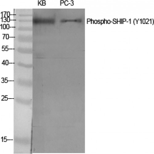 INPP5D / SHIP1 / SHIP Antibody - Western blot of Phospho-SHIP-1 (Y1021) antibody
