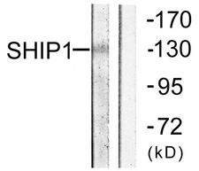 INPP5D / SHIP1 / SHIP Antibody - Western blot analysis of lysates from mouse brain, using SHIP1 Antibody. The lane on the right is blocked with the synthesized peptide.