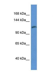 INPP5D / SHIP1 / SHIP Antibody - INPP5D / SHIP antibody Western blot of 1 Cell lysate. Antibody concentration 1 ug/ml.  This image was taken for the unconjugated form of this product. Other forms have not been tested.