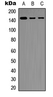 INPP5D / SHIP1 / SHIP Antibody - Western blot analysis of SHIP1 expression in Raji (A); THP1 (B); NIH3T3 (C) whole cell lysates.