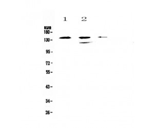 INPP5D / SHIP1 / SHIP Antibody - Western blot analysis of SHIP using anti-SHIP antibody