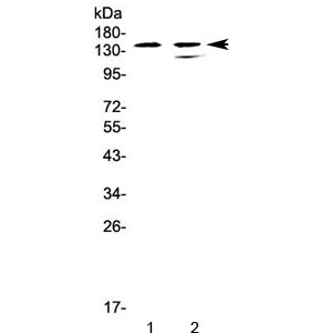 INPP5D / SHIP1 / SHIP Antibody - Western blot testing of human 1) CCRF-CEM and 2) SW620 cell lysate with SHIP1 antibody at 0.5ug/ml. Predicted molecular weight ~133 kDa, commonly observed at ~145 kDa.