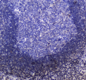 INPP5D / SHIP1 / SHIP Antibody - IHC testing of FFPE human tonsil tissue with SHIP1 antibody at 1ug/ml. Required HIER: steam section in pH6 citrate buffer for 20 min and allow to cool prior to staining.