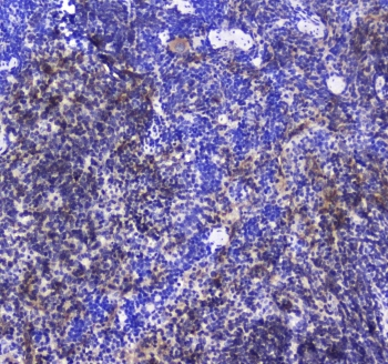 INPP5D / SHIP1 / SHIP Antibody - IHC testing of FFPE mouse spleen tissue with SHIP1 antibody at 1ug/ml. Required HIER: steam section in pH6 citrate buffer for 20 min and allow to cool prior to staining.