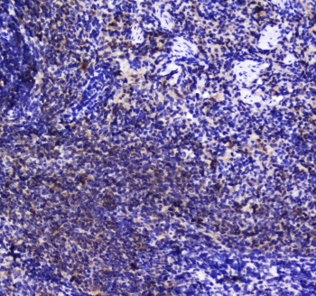 INPP5D / SHIP1 / SHIP Antibody - IHC testing of FFPE rat spleen tissue with SHIP1 antibody at 1ug/ml. Required HIER: steam section in pH6 citrate buffer for 20 min and allow to cool prior to staining.