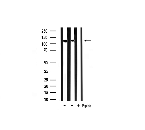 INPP5D / SHIP1 / SHIP Antibody - Western blot analysis of SHIP1 expression in various lysates
