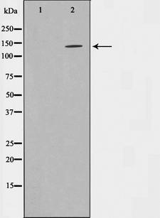 INPP5D / SHIP1 / SHIP Antibody - Western blot analysis on HepG2 cell lysates using SHIP1 antibody. The lane on the left is treated with the antigen-specific peptide.