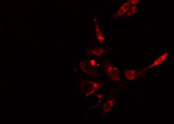 INPP5D / SHIP1 / SHIP Antibody - Staining HepG2 cells by IF/ICC. The samples were fixed with PFA and permeabilized in 0.1% Triton X-100, then blocked in 10% serum for 45 min at 25°C. The primary antibody was diluted at 1:200 and incubated with the sample for 1 hour at 37°C. An Alexa Fluor 594 conjugated goat anti-rabbit IgG (H+L) antibody, diluted at 1/600, was used as secondary antibody.
