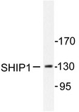 INPP5D / SHIP1 / SHIP Antibody - Western blot of SHIP1 (M1014) pAb in extracts from mouse brain.