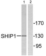 INPP5D / SHIP1 / SHIP Antibody - Western blot analysis of extracts from mouse brain cells, using SHIP1 (Ab-1020) antibody.