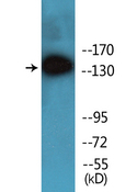 INPP5D / SHIP1 / SHIP Antibody - Western blot analysis of lysates from HepG2 cells treated with TNF 200NG/ML 30', using SHIP1 (Phospho-Tyr1021) Antibody.