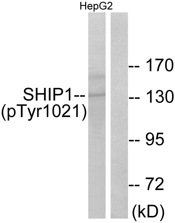 INPP5D / SHIP1 / SHIP Antibody - Western blot analysis of lysates from HepG2 cells treated with TNF 200NG/ML 30', using SHIP1 (Phospho-Tyr1021) Antibody. The lane on the right is blocked with the phospho peptide.