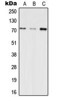 INPP5E Antibody - Western blot analysis of INPP5E expression in HEK293T (A); SP2/0 (B); H9C2 (C) whole cell lysates.