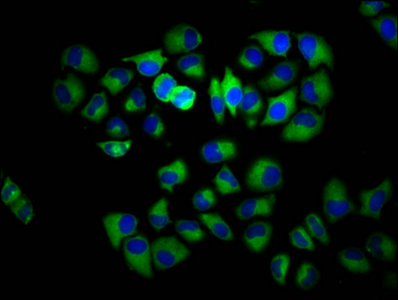 INPP5E Antibody - Immunofluorescence staining of Hela cells diluted at 1:133, counter-stained with DAPI. The cells were fixed in 4% formaldehyde, permeabilized using 0.2% Triton X-100 and blocked in 10% normal Goat Serum. The cells were then incubated with the antibody overnight at 4°C.The Secondary antibody was Alexa Fluor 488-congugated AffiniPure Goat Anti-Rabbit IgG (H+L).