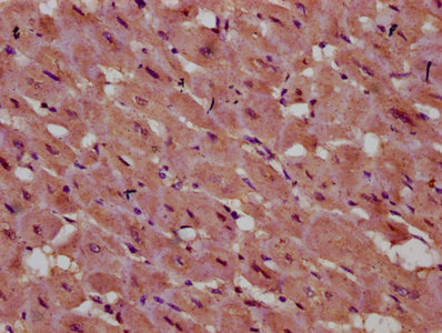 INPP5E Antibody - Immunohistochemistry Dilution at 1:400 and staining in paraffin-embedded human heart tissue performed on a Leica BondTM system. After dewaxing and hydration, antigen retrieval was mediated by high pressure in a citrate buffer (pH 6.0). Section was blocked with 10% normal Goat serum 30min at RT. Then primary antibody (1% BSA) was incubated at 4°C overnight. The primary is detected by a biotinylated Secondary antibody and visualized using an HRP conjugated SP system.