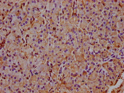 INPP5E Antibody - Immunohistochemistry Dilution at 1:400 and staining in paraffin-embedded human pancreatic tissue performed on a Leica BondTM system. After dewaxing and hydration, antigen retrieval was mediated by high pressure in a citrate buffer (pH 6.0). Section was blocked with 10% normal Goat serum 30min at RT. Then primary antibody (1% BSA) was incubated at 4°C overnight. The primary is detected by a biotinylated Secondary antibody and visualized using an HRP conjugated SP system.