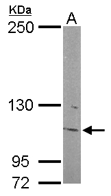 INPP5F Antibody - Sample (50 ug of whole cell lysate). A: mouse brain. 5% SDS PAGE. INPP5F antibody diluted at 1:500.
