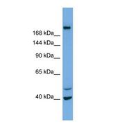 INPP5F Antibody - Western blot of Human NCI-H226. INPP5F antibody dilution 1.0 ug/ml.  This image was taken for the unconjugated form of this product. Other forms have not been tested.