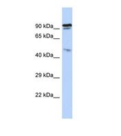 INPP5J / PIB5PA Antibody - Western blot of Human HepG2. INPP5J antibody dilution 1.0 ug/ml.  This image was taken for the unconjugated form of this product. Other forms have not been tested.