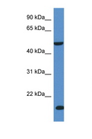 INPP5K / SKIP Antibody - INPP5K / SKIP antibody Western blot of Fetal Liver lysate. Antibody concentration 1 ug/ml.  This image was taken for the unconjugated form of this product. Other forms have not been tested.