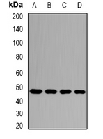 INPP5K / SKIP Antibody - Western blot analysis of SKIP expression in mouse brain (A); rat brain (B) whole cell lysates.