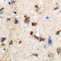INPP5K / SKIP Antibody - Immunohistochemical analysis of SKIP staining in rat brain formalin fixed paraffin embedded tissue section. The section was pre-treated using heat mediated antigen retrieval with sodium citrate buffer (pH 6.0). The section was then incubated with the antibody at room temperature and detected using an HRP conjugated compact polymer system. DAB was used as the chromogen. The section was then counterstained with hematoxylin and mounted with DPX.