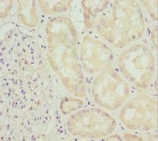 INPP5K / SKIP Antibody - Immunohistochemistry of paraffin-embedded human kidney tissue at dilution 1:100
