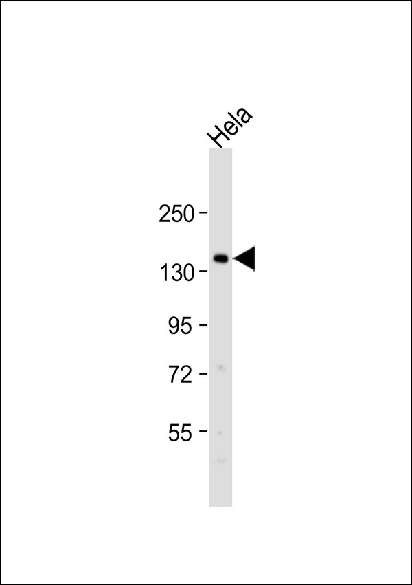 INPPL1 / SHIP2 Antibody - Anti-SHIP2 Antibody at 1:1000 dilution + HeLa whole cell lysate Lysates/proteins at 20 ug per lane. Secondary Goat Anti-Rabbit IgG, (H+L), Peroxidase conjugated at 1:10000 dilution. Predicted band size: 139 kDa. Blocking/Dilution buffer: 5% NFDM/TBST.