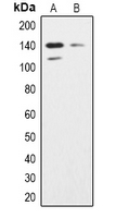 INPPL1 / SHIP2 Antibody - Western blot analysis of SHIP2 expression in K562 (A); HeLa (B) whole cell lysates.