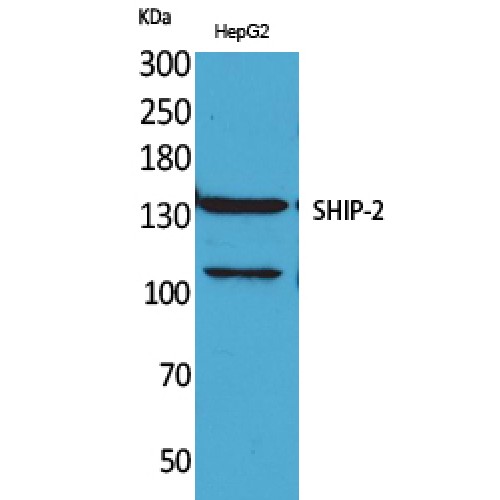 INPPL1 / SHIP2 Antibody - Western blot of SHIP-2 antibody