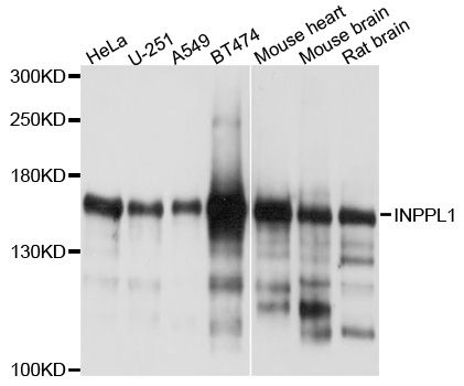 INPPL1 / SHIP2 Antibody - Western blot analysis of extracts of various cells.