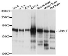 INPPL1 / SHIP2 Antibody - Western blot analysis of extracts of various cells.
