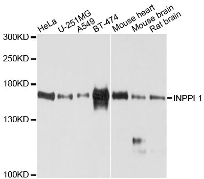 INPPL1 / SHIP2 Antibody - Western blot analysis of extracts of various cell lines, using INPPL1 antibody at 1:1000 dilution. The secondary antibody used was an HRP Goat Anti-Rabbit IgG (H+L) at 1:10000 dilution. Lysates were loaded 25ug per lane and 3% nonfat dry milk in TBST was used for blocking. An ECL Kit was used for detection and the exposure time was 60s.