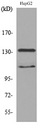 INPPL1 / SHIP2 Antibody - Western blot analysis of lysate from HepG2 cells, using INPPL1 Antibody.