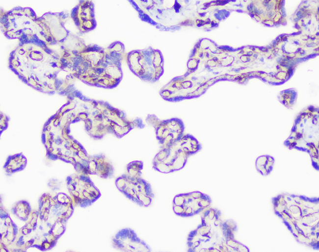 INPPL1 / SHIP2 Antibody - IHC analysis of INPPL1 using anti-INPPL1 antibody. INPPL1 was detected in paraffin-embedded section of human placenta tissue. Heat mediated antigen retrieval was performed in citrate buffer (pH6, epitope retrieval solution) for 20 mins. The tissue section was blocked with 10% goat serum. The tissue section was then incubated with 1µg/ml rabbit anti-INPPL1 Antibody overnight at 4°C. Biotinylated goat anti-rabbit IgG was used as secondary antibody and incubated for 30 minutes at 37°C. The tissue section was developed using Strepavidin-Biotin-Complex (SABC) with DAB as the chromogen.
