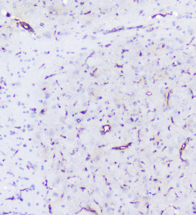 INPPL1 / SHIP2 Antibody - IHC analysis of INPPL1 using anti-INPPL1 antibody. INPPL1 was detected in paraffin-embedded section of rat brain tissue. Heat mediated antigen retrieval was performed in citrate buffer (pH6, epitope retrieval solution) for 20 mins. The tissue section was blocked with 10% goat serum. The tissue section was then incubated with 1µg/ml rabbit anti-INPPL1 Antibody overnight at 4°C. Biotinylated goat anti-rabbit IgG was used as secondary antibody and incubated for 30 minutes at 37°C. The tissue section was developed using Strepavidin-Biotin-Complex (SABC) with DAB as the chromogen.