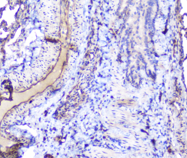 INPPL1 / SHIP2 Antibody - IHC analysis of INPPL1 using anti-INPPL1 antibody. INPPL1 was detected in paraffin-embedded section of rat lung tissue. Heat mediated antigen retrieval was performed in citrate buffer (pH6, epitope retrieval solution) for 20 mins. The tissue section was blocked with 10% goat serum. The tissue section was then incubated with 1µg/ml rabbit anti-INPPL1 Antibody overnight at 4°C. Biotinylated goat anti-rabbit IgG was used as secondary antibody and incubated for 30 minutes at 37°C. The tissue section was developed using Strepavidin-Biotin-Complex (SABC) with DAB as the chromogen.